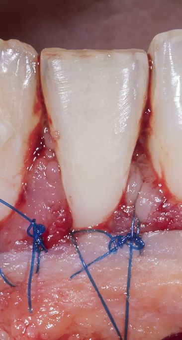 Periodontologia